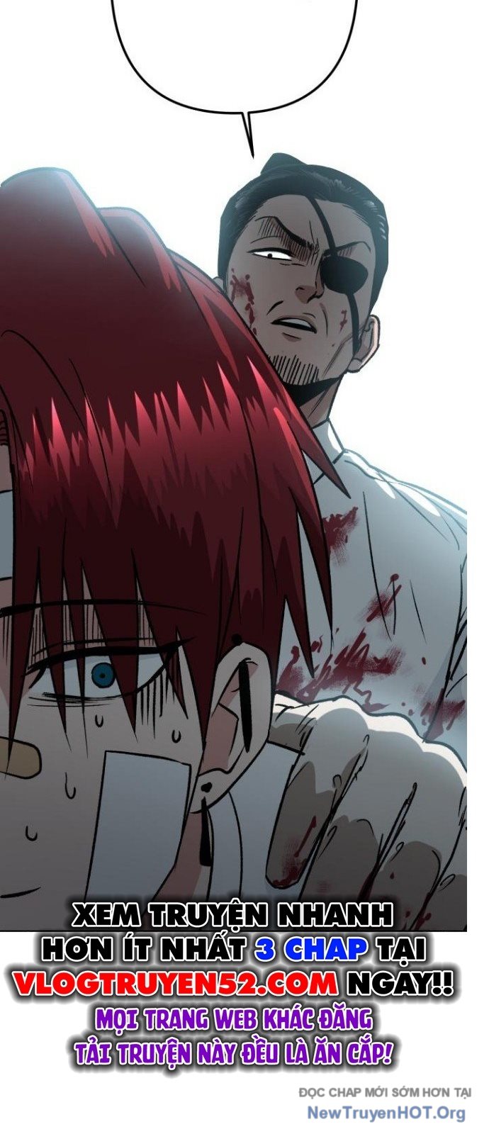 Tên Lưu Manh Và Tiểu Thư Xã Hội Đen Chap 3 - Next Chap 4