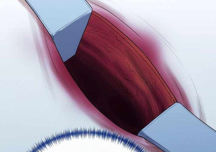 Thần Y Hoa Đà Tái Xuất Chap 37 - Next Chap 38