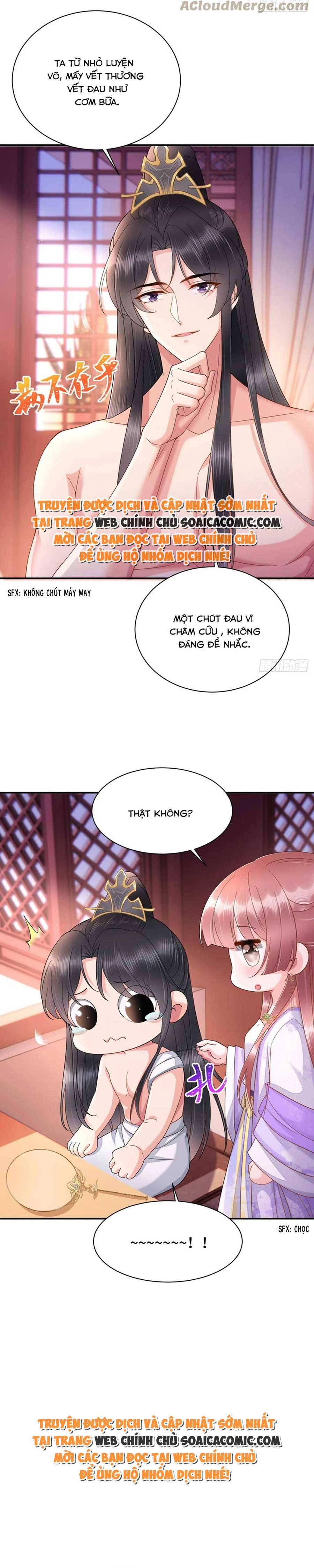 Thần Y Vương Phi Có Miệng Quạ Đen Chap 26 - Next Chap 27