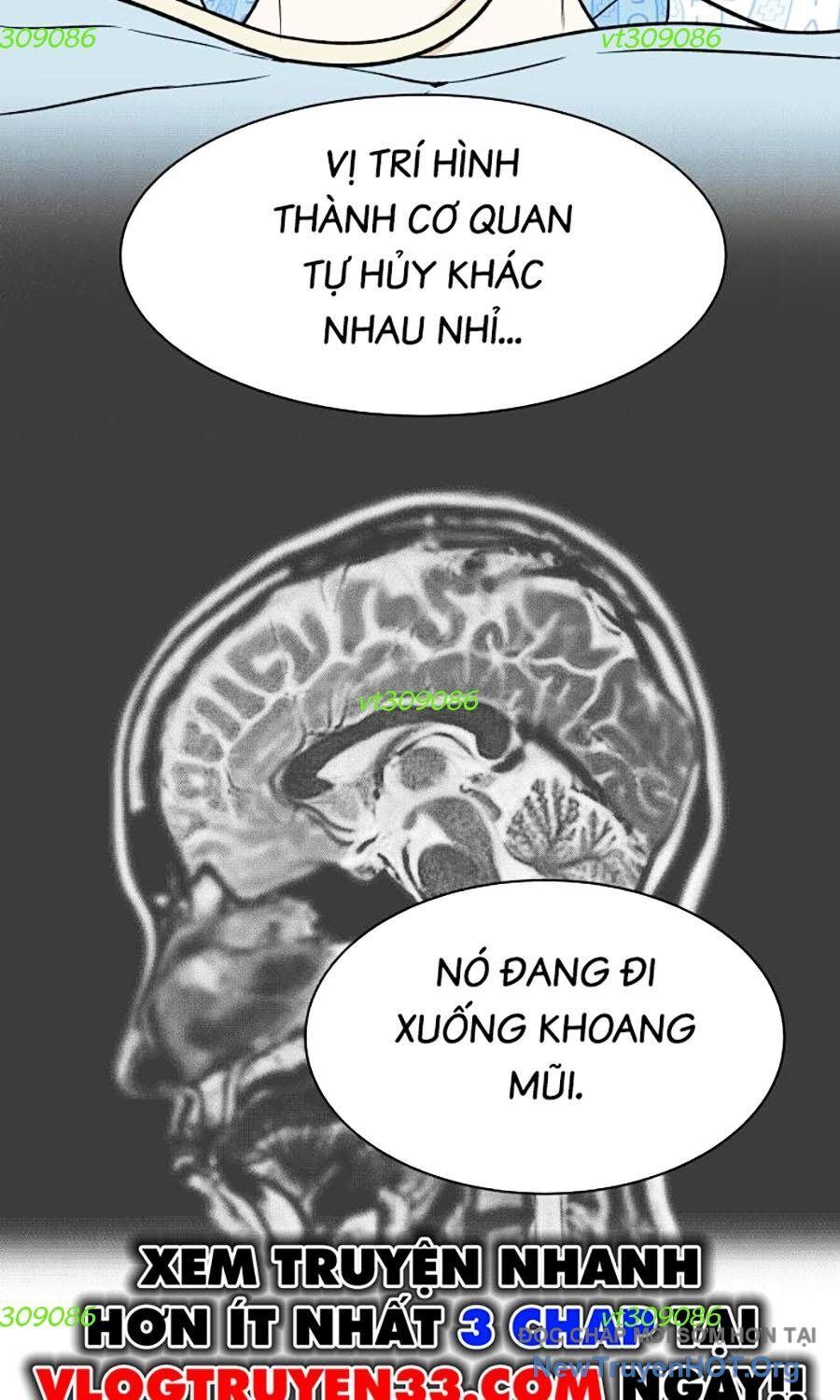 Cơ Quan Tự Hủy Chap 27 - Next Chap 28