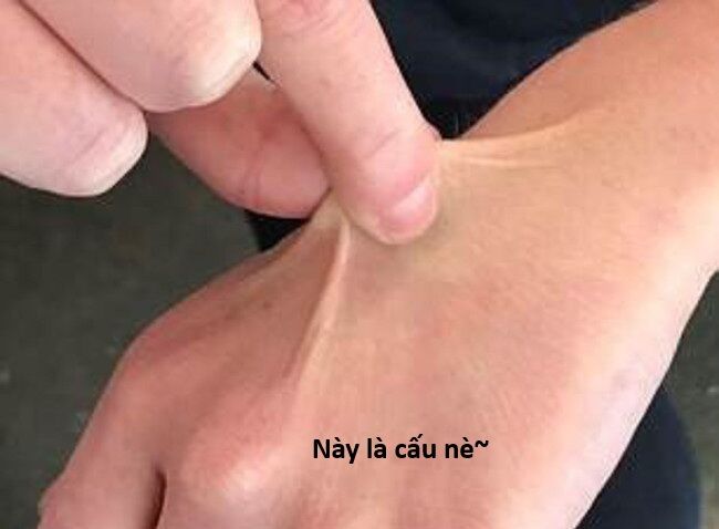 Hổ Đến Chơi Nhà (Puchimasu Miếu) Chap 144 - Next Chap 145