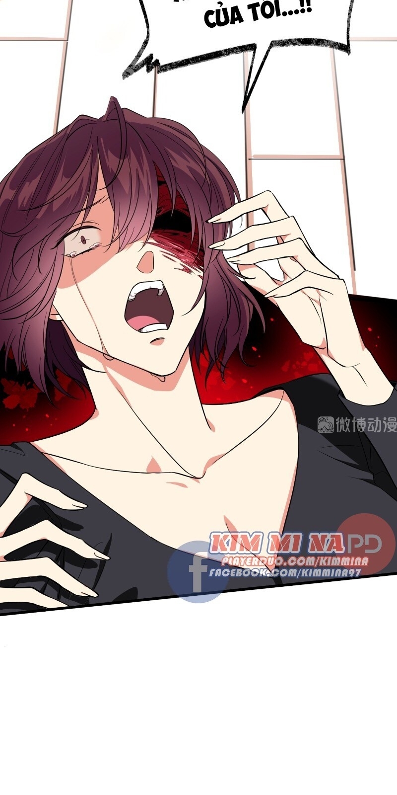 Vết Cắn Trí Mạng Chap 2 - Next Chap 3