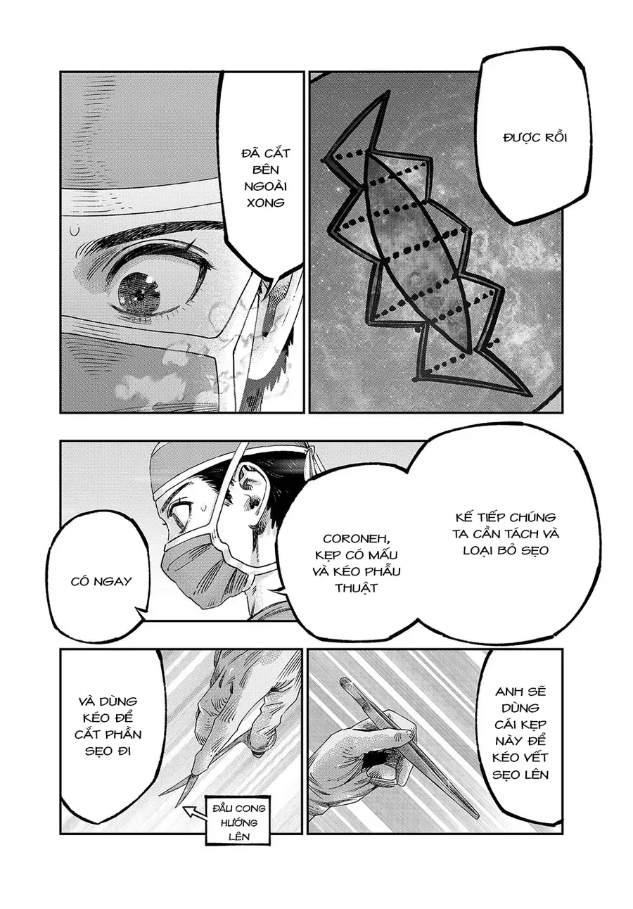 Tôi Dùng Y Học Hiện Đại Để Đối Đầu Với Ma Thuật Cổ Đại Chap 36 - Next Chap 37