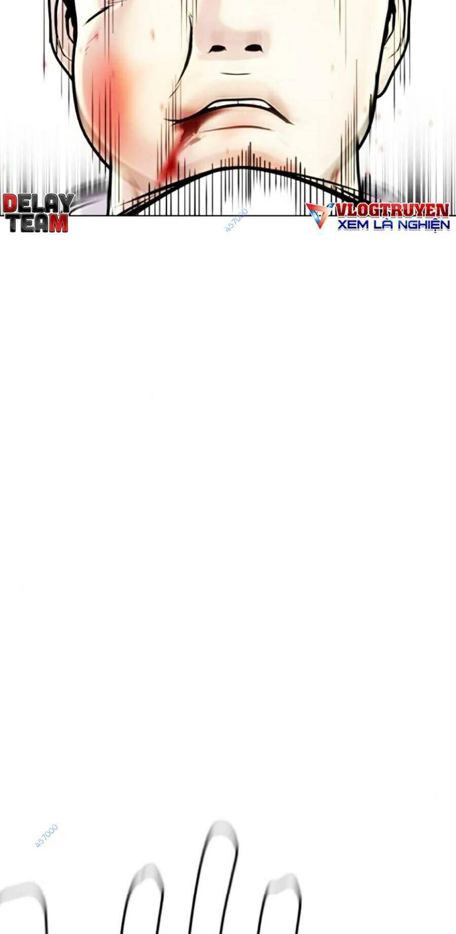 Loser Giỏi Võ Chap 3 - Next Chap 4